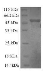 SDS-PAGE