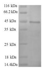 SDS-PAGE