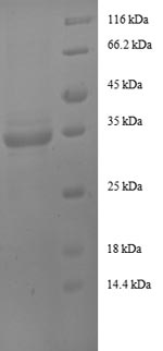 SDS-PAGE