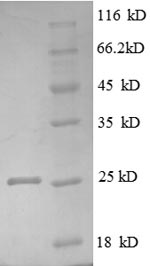 SDS-PAGE