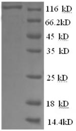 SDS-PAGE