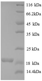 SDS-PAGE