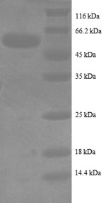 SDS-PAGE