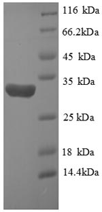 SDS-PAGE