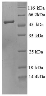 SDS-PAGE