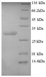 SDS-PAGE