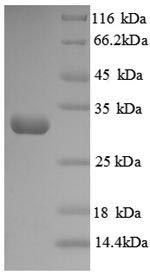 SDS-PAGE