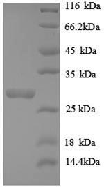 SDS-PAGE