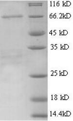 SDS-PAGE