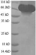 SDS-PAGE