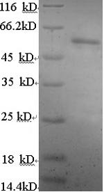 SDS-PAGE