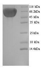 SDS-PAGE