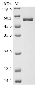 SDS-PAGE