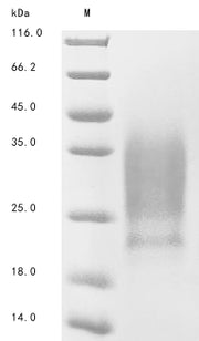 SDS-PAGE