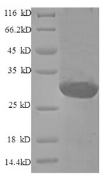 SDS-PAGE