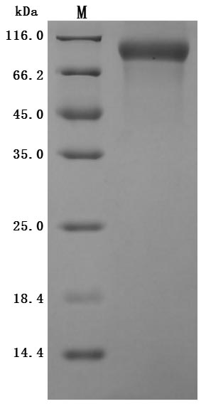 SDS-PAGE
