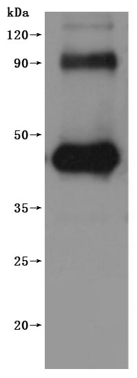 Western Blot