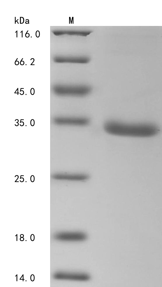 SDS-PAGE
