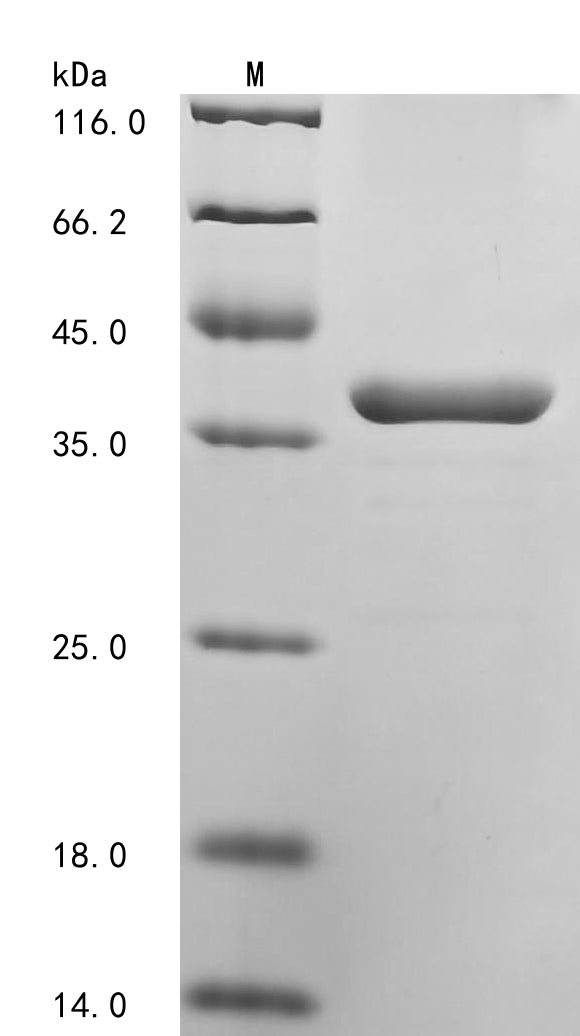 SDS-PAGE