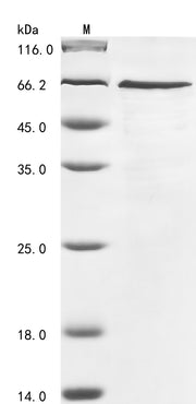 SDS-PAGE
