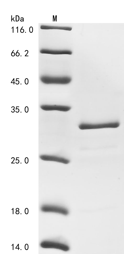 SDS-PAGE