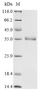 SDS-PAGE