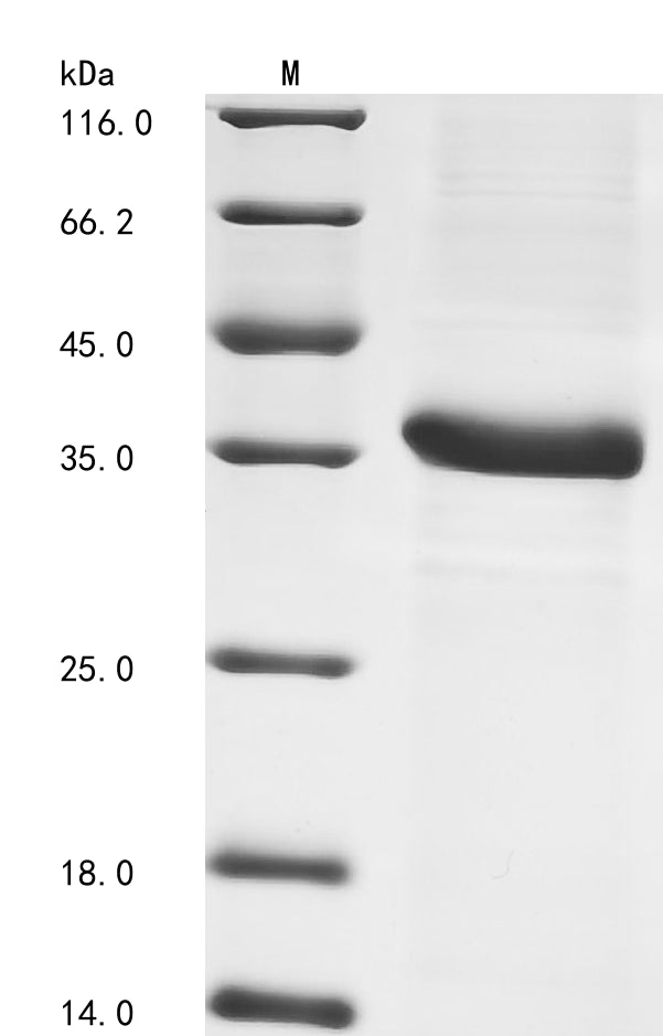 SDS-PAGE