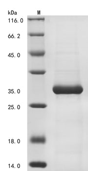 SDS-PAGE