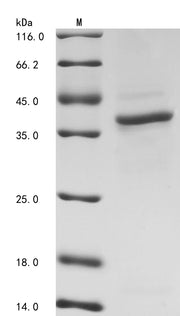 SDS-PAGE