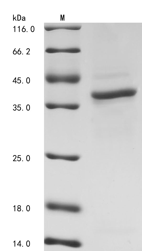 SDS-PAGE