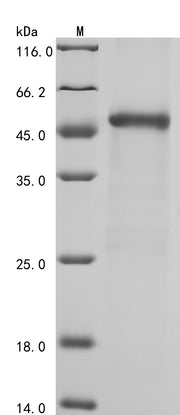 SDS-PAGE