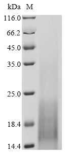 SDS-PAGE