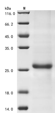 SDS-PAGE