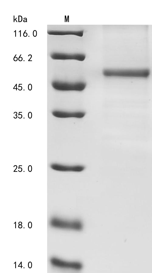 SDS-PAGE