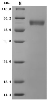 SDS-PAGE