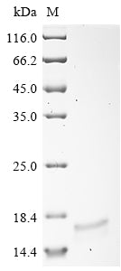SDS-PAGE