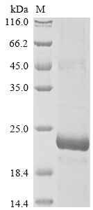 SDS-PAGE