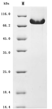 SDS-PAGE