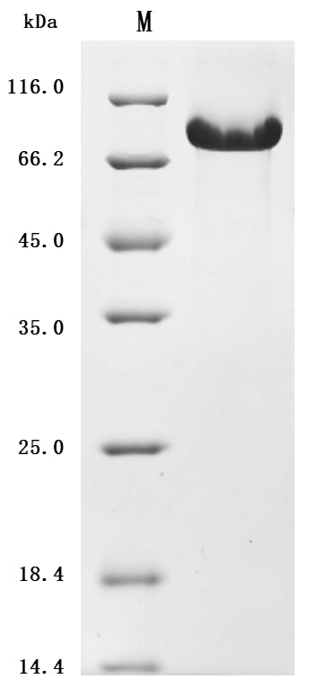 SDS-PAGE