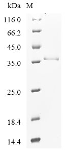 SDS-PAGE