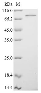 SDS-PAGE