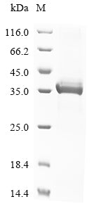 SDS-PAGE