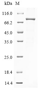 SDS-PAGE