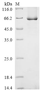 SDS-PAGE