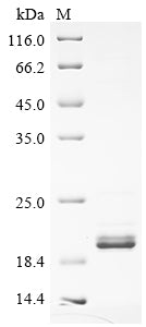SDS-PAGE