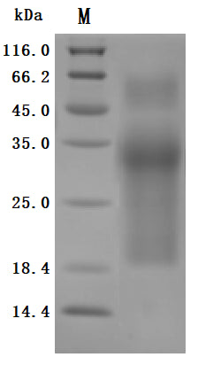 SDS-PAGE