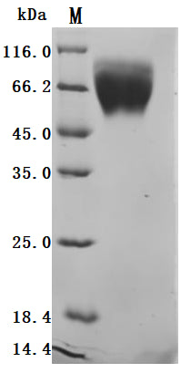SDS-PAGE
