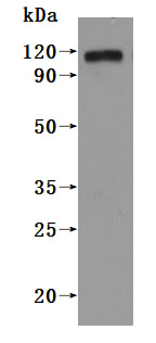 Western Blot