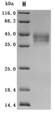 SDS-PAGE