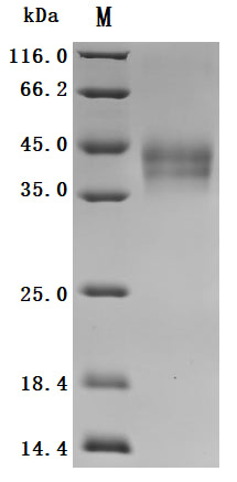 SDS-PAGE